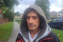 Tự nhổ răng suốt hơn 10 năm vì không có tiền đi nha sĩ