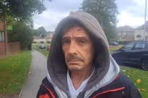 Tự nhổ răng suốt hơn 10 năm vì không có tiền đi nha sĩ