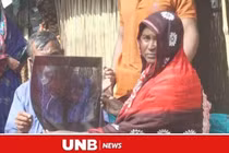 Đau bụng suốt 20 năm, người phụ nữ bàng hoàng khi biết nguyên nhân