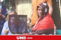 Đau bụng suốt 20 năm, người phụ nữ bàng hoàng khi biết nguyên nhân