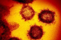 Đức: Phát hiện kháng thể ngăn chặn SARS-CoV-2, có thể chế thuốc trị COVID-19