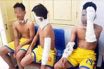 Nổ bóng bay 4 người bỏng nặng: Cẩn trọng khi trẻ chơi bóng này 