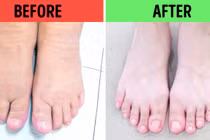 10 cách ngâm chân giúp trị một số vấn đề sức khỏe khó chịu