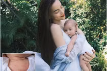 Con gái Hà Hồ mẩn đỏ khắp người: Nguyên nhân, xứ lý thế nào?