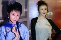 Những ngôi sao châu Á hóa thành “thảm họa thẩm mỹ”