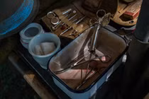 Người đàn ông tự phẫu thuật nâng mũi theo Youtube và cái kết