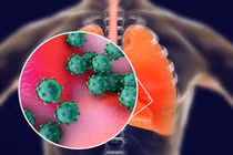 Căn bệnh COVID-19 tấn công cơ thể con người kinh khủng thế nào?