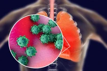 Căn bệnh COVID-19 tấn công cơ thể con người kinh khủng thế nào?