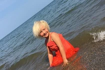 Căn bệnh lạ khiến cô bé có mái tóc dựng đứng