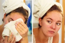 Vì sao không nên dùng khăn lau khô mặt sau khi rửa?