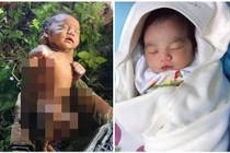 Bị bỏ rơi trong rừng 2 ngày, bé sơ sinh sống sót thần kỳ