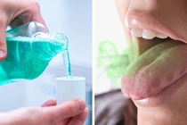 Nguyên nhân khiến hơi thở buổi sáng “nặng mùi” và cách khắc phục