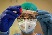 Việt Nam thử nghiệm dùng huyết tương bệnh nhân COVID-19 khỏi bệnh điều trị ca bệnh nặng