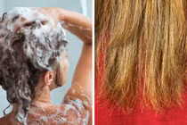 7 dấu hiệu “cảnh báo” bạn gội đầu quá thường xuyên