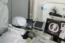 Virus gây COVID-19 còn tồn tại sâu trong phổi người khỏi bệnh