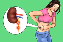 Nếu bạn đột ngột ngừng đổ mồ hôi, hãy thận trọng các vấn đề này