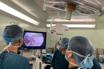 BV Bạch Mai cắt gan nội soi thành công cho bệnh nhân ung thư gan