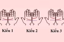 Xòe bàn tay và xem điều này để biết hôn nhân viên mãn hay trục trặc