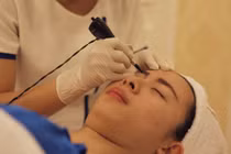 Lý do không ngờ khiến người phụ nữ tử vong sau khi xăm lông mày 