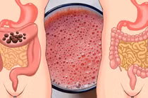 7 cách để làm sạch đại tràng và giữ gìn sức khoẻ