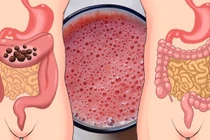 7 cách để làm sạch đại tràng và giữ gìn sức khoẻ