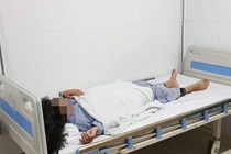 BV Da liễu T.Ư thông tin chính thức vụ bé gái nâng mũi bị hỏng mắt