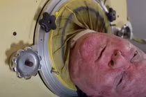 Cụ ông sống trong lá phổi sắt suốt 65 năm mong muốn lấy vợ