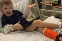 Kỳ lạ cậu bé gãy chân cũng không cảm nhận được cơn đau