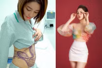 Hotgirl Trâm Anh khoe eo thon sau khi hút mỡ bụng 3 tháng