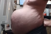 Hoãn phẫu thuật vì dịch, người đàn ông phải mang “bụng bầu 9 tháng”