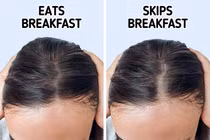 10 thói quen hàng ngày khiến tóc bạn ngày càng “hói”