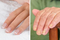 7 bộ phận cơ thể “tố cáo” tuổi thật mà bạn không thể giấu