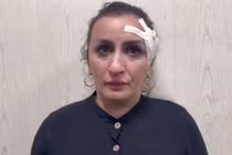 Mẹ độc ác bán con trai mới sinh để lấy tiền sửa mũi