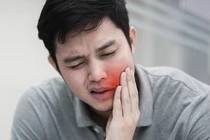 Chàng trai 24 tuổi hóa trẻ con chỉ vì 3 chiếc răng thối