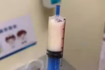 Đau bụng đi khám, chàng trai khiến bác sĩ hết hồn vì máu sữa