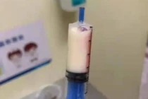 Đau bụng đi khám, chàng trai khiến bác sĩ hết hồn vì máu sữa