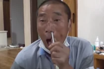 Người đàn ông bị “cả đàn nhện làm tổ trong não”, sự thật sốc