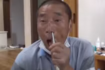 Người đàn ông bị “cả đàn nhện làm tổ trong não”, sự thật sốc