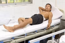 5 phút bị sét đánh 2 lần, người đàn ông sống sót ngoạn mục