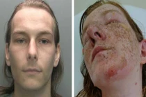 Cô gái bị em trai chồng sắp cưới dội nước sôi vì...thú cưng