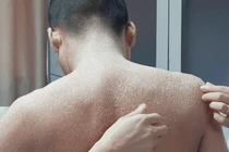 Cha mẹ kết hôn cận huyết, con trai hóa “người rắn” đáng sợ