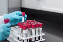 Nhóm máu quyết định chỉ số thông minh? Chuyên gia xếp hạng