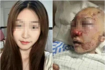 Đi vệ sinh nơi công cộng, cô gái gặp họa kinh hoàng