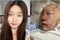 Đi vệ sinh nơi công cộng, cô gái gặp họa kinh hoàng