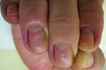 Tin bác sĩ bệnh viện lớn, người đàn ông tiêu chảy suýt chết