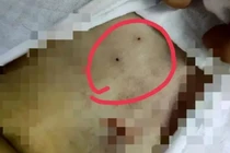 Tiếng hét thảm phơi bày chuyện ghê rợn trong phòng phẫu thuật 