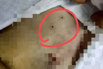 Tiếng hét thảm phơi bày chuyện ghê rợn trong phòng phẫu thuật 