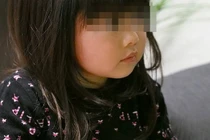 Bé gái 7 tuổi đột nhiên mờ mắt vì bố mẹ làm điều này 