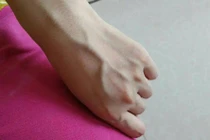 Nhìn gân xanh nổi chỗ nào đoán ngay ra bệnh chỗ đó 