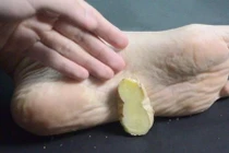 Xát gừng vào 2 điểm trên cơ thể mỗi tối, tác dụng kinh ngạc